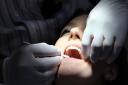 There are no NHS spaces in Warrington for a dentist