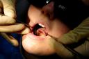 Dozens of children with rotten teeth were taken to Warrington hospital last year