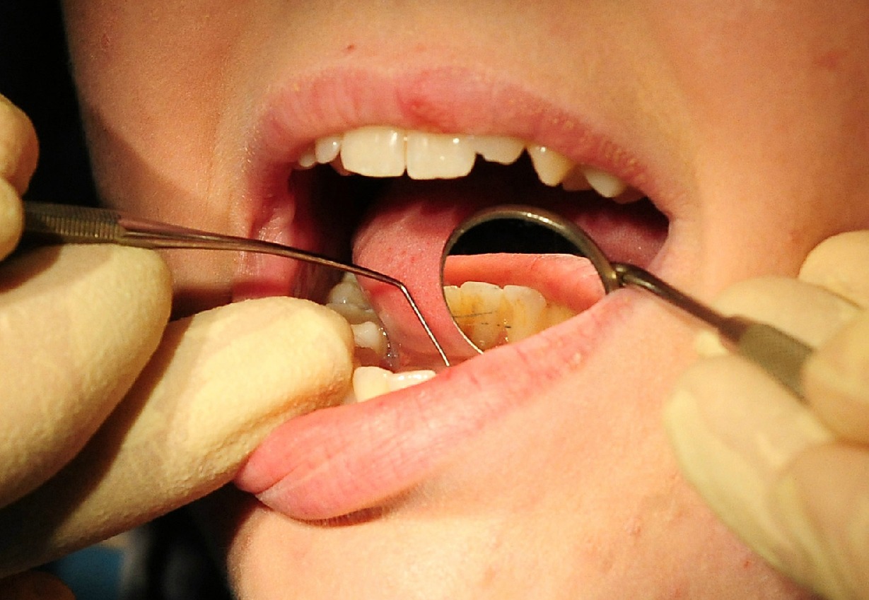 Warrington patients report difficulties at dentists as unions warn sector 'hanging by a thread'