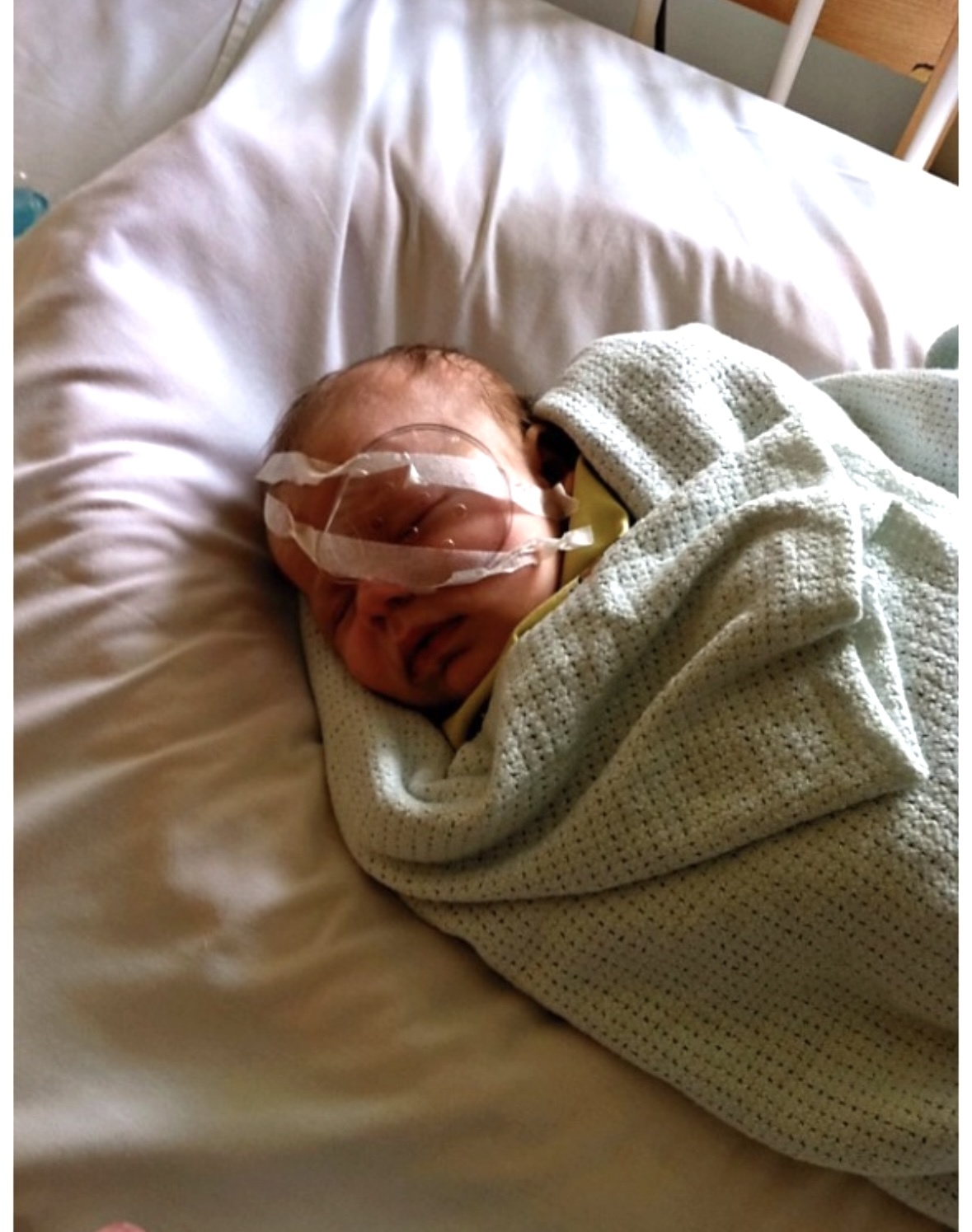Harrison was born with a congenital cataract which had to be removed when he was just eight weeks old 